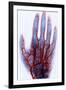 X-ray of Blood Vessels-Science Source-Framed Giclee Print