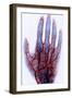 X-ray of Blood Vessels-Science Source-Framed Giclee Print