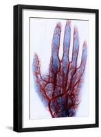 X-ray of Blood Vessels-Science Source-Framed Giclee Print