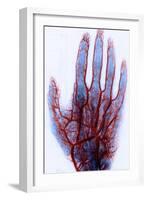 X-ray of Blood Vessels-Science Source-Framed Giclee Print