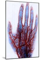 X-ray of Blood Vessels-Science Source-Mounted Giclee Print