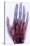 X-ray of Blood Vessels-Science Source-Stretched Canvas