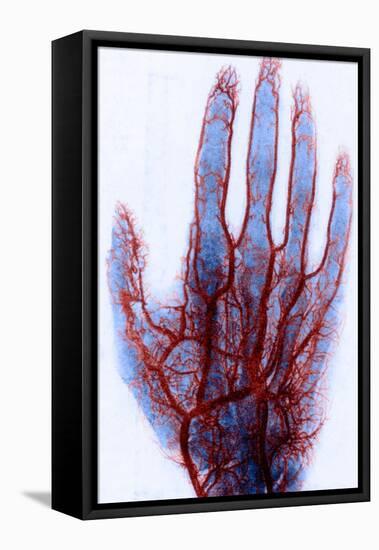 X-ray of Blood Vessels-Science Source-Framed Stretched Canvas