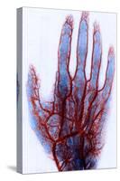 X-ray of Blood Vessels-Science Source-Stretched Canvas