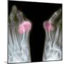 X-ray of Bunions on the Toes-Mike Devlin-Mounted Premium Photographic Print