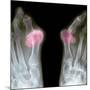 X-ray of Bunions on the Toes-Mike Devlin-Mounted Photographic Print