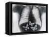 X-ray of butterflies in the stomach-Thom Lang-Framed Stretched Canvas