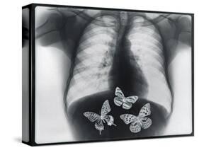 X-ray of butterflies in the stomach-Thom Lang-Stretched Canvas