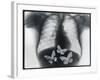 X-ray of butterflies in the stomach-Thom Lang-Framed Photographic Print