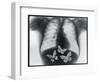 X-ray of butterflies in the stomach-Thom Lang-Framed Photographic Print