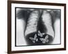 X-ray of butterflies in the stomach-Thom Lang-Framed Photographic Print