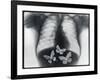 X-ray of butterflies in the stomach-Thom Lang-Framed Photographic Print
