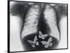 X-ray of butterflies in the stomach-Thom Lang-Stretched Canvas