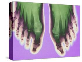 X-ray of Feet-null-Stretched Canvas