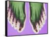 X-ray of Feet-null-Framed Stretched Canvas