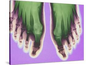 X-ray of Feet-null-Stretched Canvas