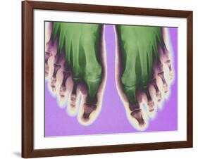 X-ray of Feet-null-Framed Photographic Print