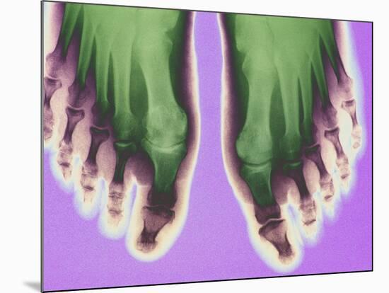 X-ray of Feet-null-Mounted Photographic Print