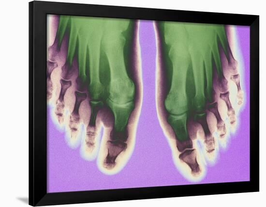 X-ray of Feet-null-Framed Photographic Print