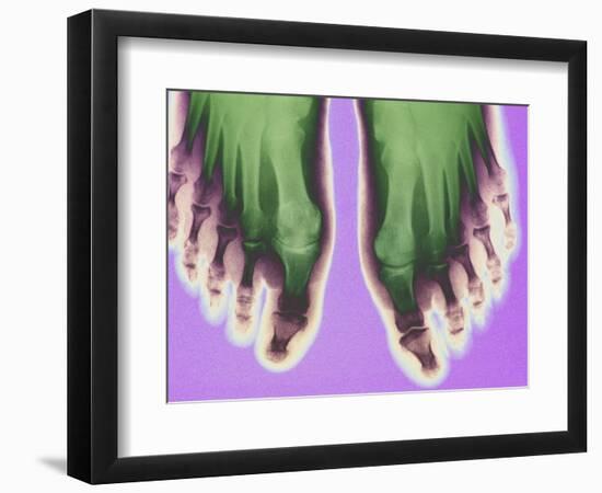 X-ray of Feet-null-Framed Photographic Print