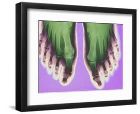 X-ray of Feet-null-Framed Photographic Print