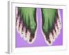 X-ray of Feet-null-Framed Photographic Print