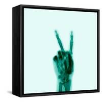 X-Ray of Hand Doing Peace Sign-null-Framed Stretched Canvas