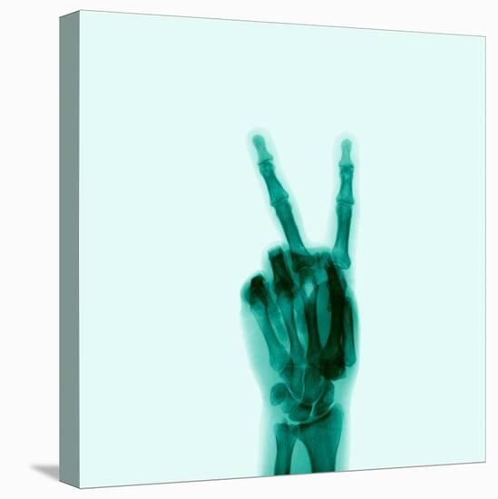 X-Ray of Hand Doing Peace Sign-null-Stretched Canvas