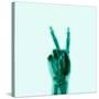 X-Ray of Hand Doing Peace Sign-null-Stretched Canvas