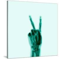 X-Ray of Hand Doing Peace Sign-null-Stretched Canvas
