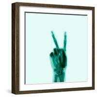 X-Ray of Hand Doing Peace Sign-null-Framed Premium Photographic Print