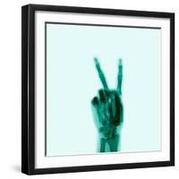 X-Ray of Hand Doing Peace Sign-null-Framed Premium Photographic Print
