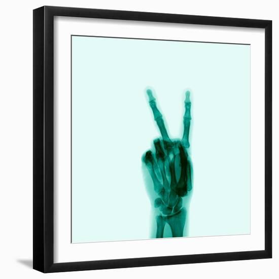 X-Ray of Hand Doing Peace Sign-null-Framed Premium Photographic Print
