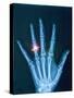 X-ray of hand with diamond ring-Thom Lang-Stretched Canvas