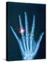 X-ray of hand with diamond ring-Thom Lang-Stretched Canvas