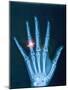 X-ray of hand with diamond ring-Thom Lang-Mounted Photographic Print