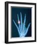 X-ray of hand with diamond ring-Thom Lang-Framed Photographic Print