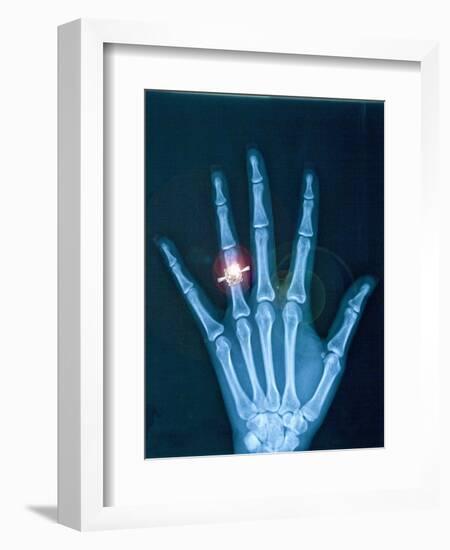 X-ray of hand with diamond ring-Thom Lang-Framed Photographic Print