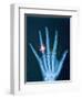 X-ray of hand with diamond ring-Thom Lang-Framed Photographic Print