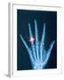 X-ray of hand with diamond ring-Thom Lang-Framed Photographic Print