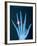 X-ray of hand with diamond ring-Thom Lang-Framed Photographic Print