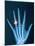 X-ray of hand with diamond ring-Thom Lang-Mounted Photographic Print