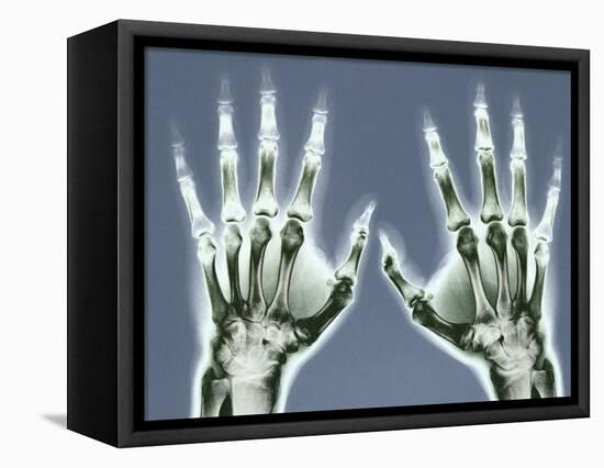 X-ray of Hands-null-Framed Stretched Canvas