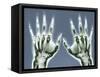 X-ray of Hands-null-Framed Stretched Canvas