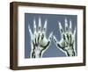 X-ray of Hands-null-Framed Photographic Print