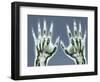 X-ray of Hands-null-Framed Photographic Print