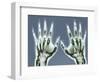 X-ray of Hands-null-Framed Photographic Print