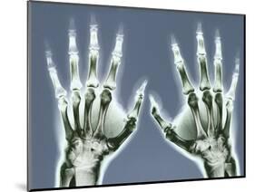 X-ray of Hands-null-Mounted Photographic Print