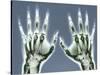 X-ray of Hands-null-Stretched Canvas