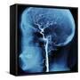 X-Ray of Human Head-Robert Llewellyn-Framed Stretched Canvas